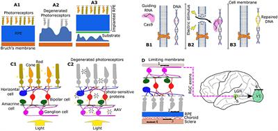 Visual Prosthesis: Interfacing Stimulating Electrodes with Retinal Neurons to Restore Vision